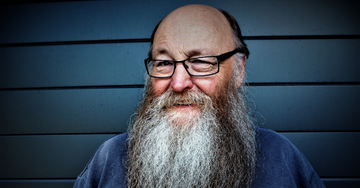 DHT related hair-loss. Why you need to know before you act.