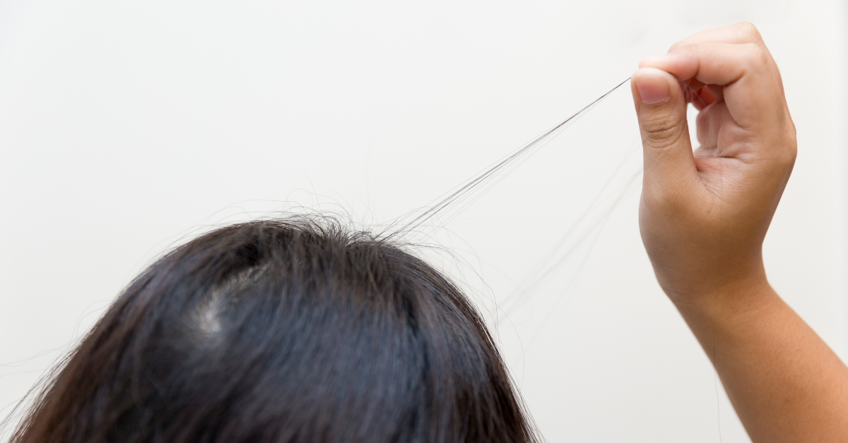 Trichotillomania