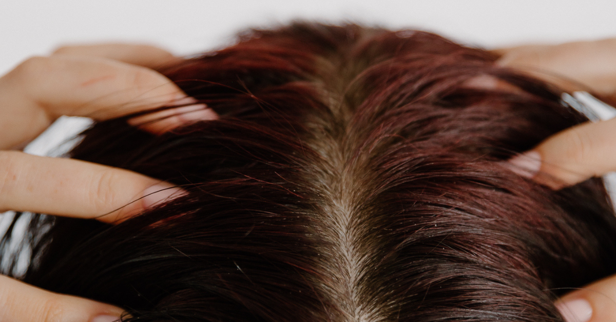 Metabolic Conditions and Hair Health